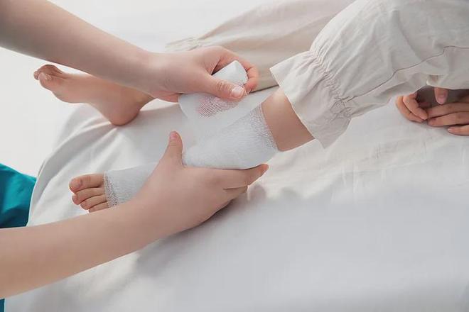 跌倒占儿童意外60%！家长如何为孩子预防风险(图3)